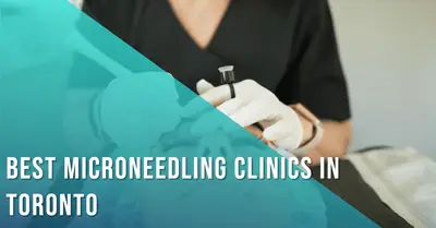5 Best Clinics for Microneedling in Toronto (2026)