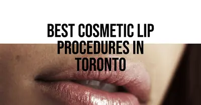 5 Best Cosmetic Lip Procedures in Toronto (2026)