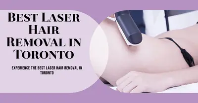 5 Best Laser Hair Removal Services in Toronto (2026)