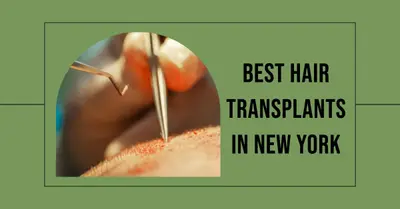 5 Best Hair Transplants in New York (2026)
