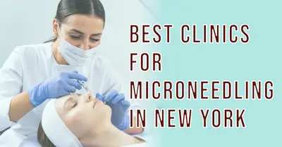 5 Best Clinics for Microneedling in New York (2026)