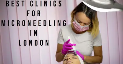 5 Best Clinics for Microneedling in London (2026)