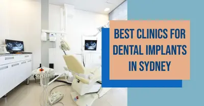 5 Best Clinics for Dental Implants in Sydney (2026)