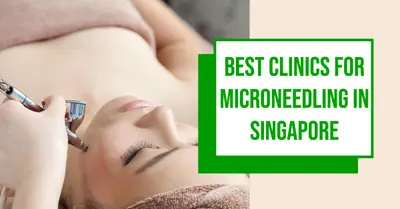 5 Best Clinics for Microneedling in Singapore (2026)