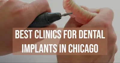 5 Best Clinics for Dental Implants in Chicago (2026)