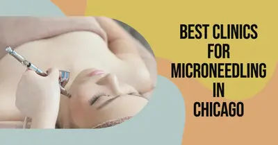 5 Best Clinics for Microneedling in Chicago (2026)