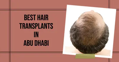 4 Best Hair Transplants In Abu Dhabi (2026)