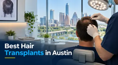 3 Best Hair Transplants in Austin (2026)