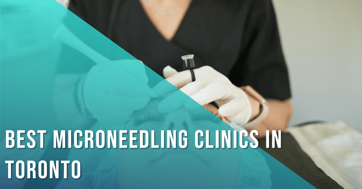 Best Clinics For Microneedling In Toronto (2026)