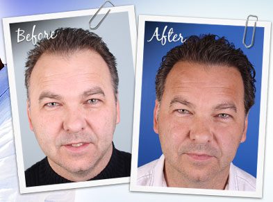 Seager Hair Transplant Centre logo