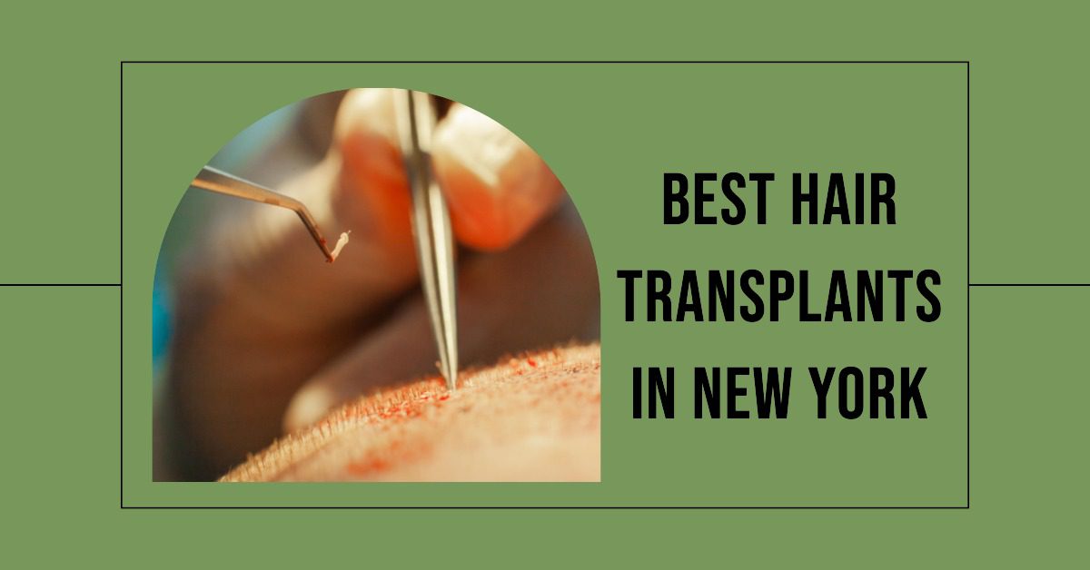 Best Hair Transplants In New York (2026)