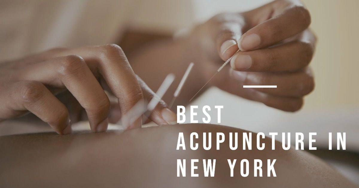 Best Acupuncture In New York (2026)