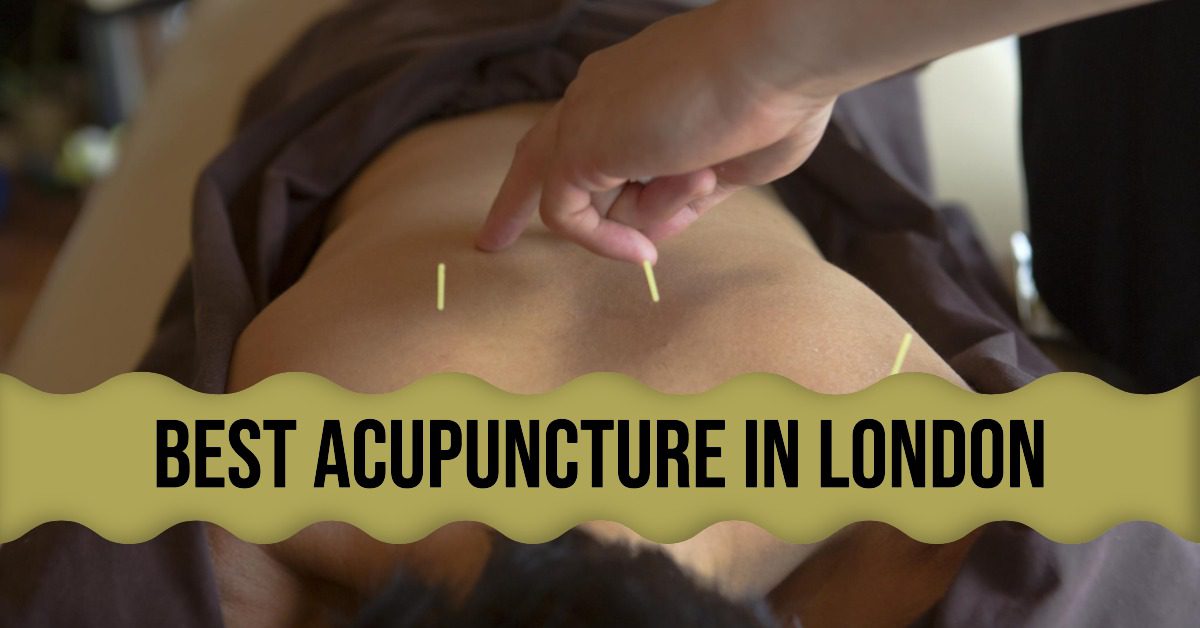 Best Acupuncture In London (2026)