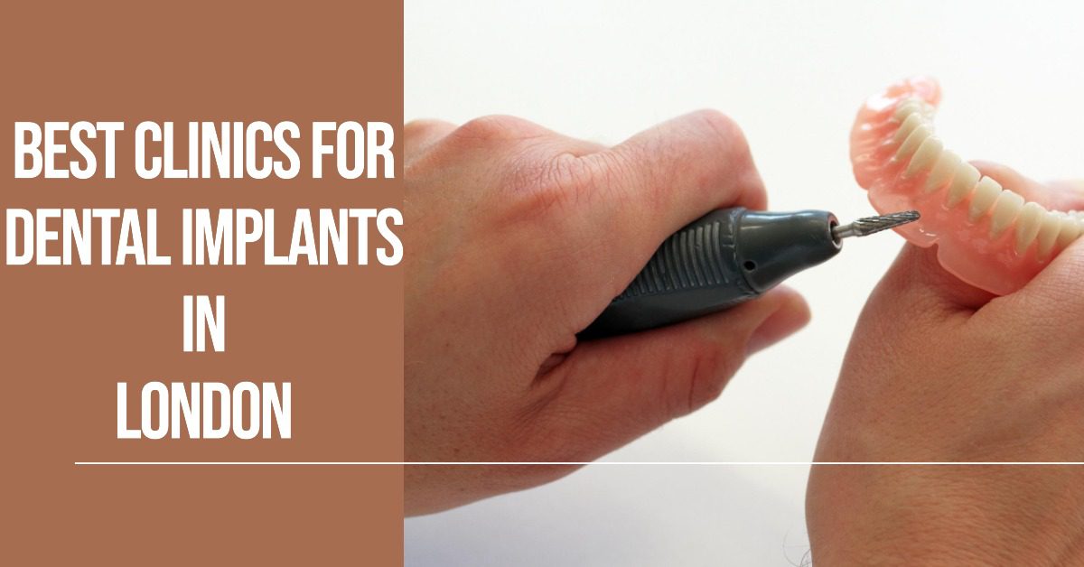 Best Clinics For Dental Implants In London (2026)