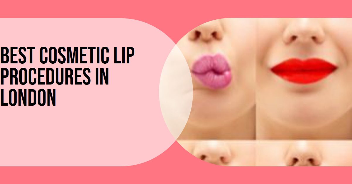 Best Cosmetic Lip Procedures In London (2026)
