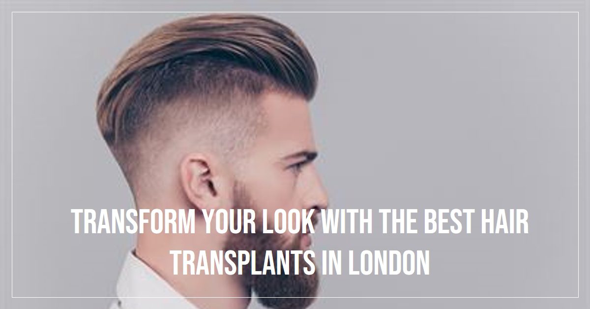 Best Hair Transplants In London (2026)