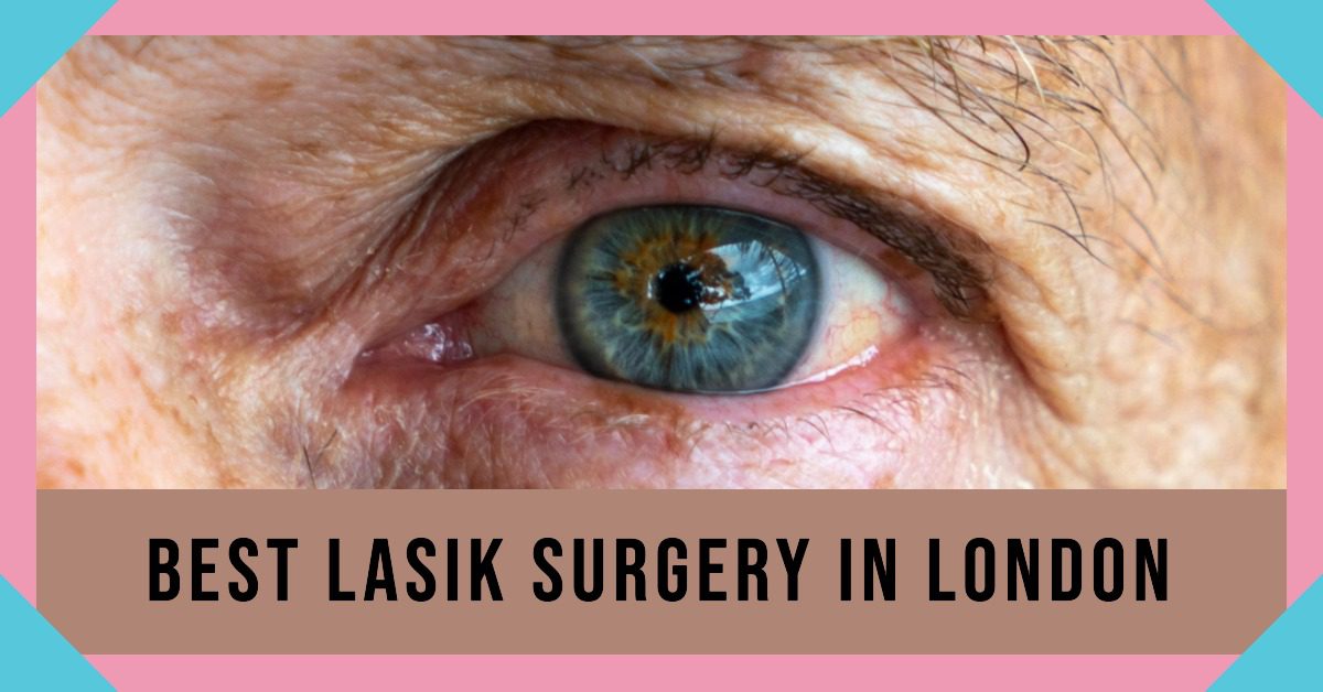 Best Lasik Surgery In London (2026)