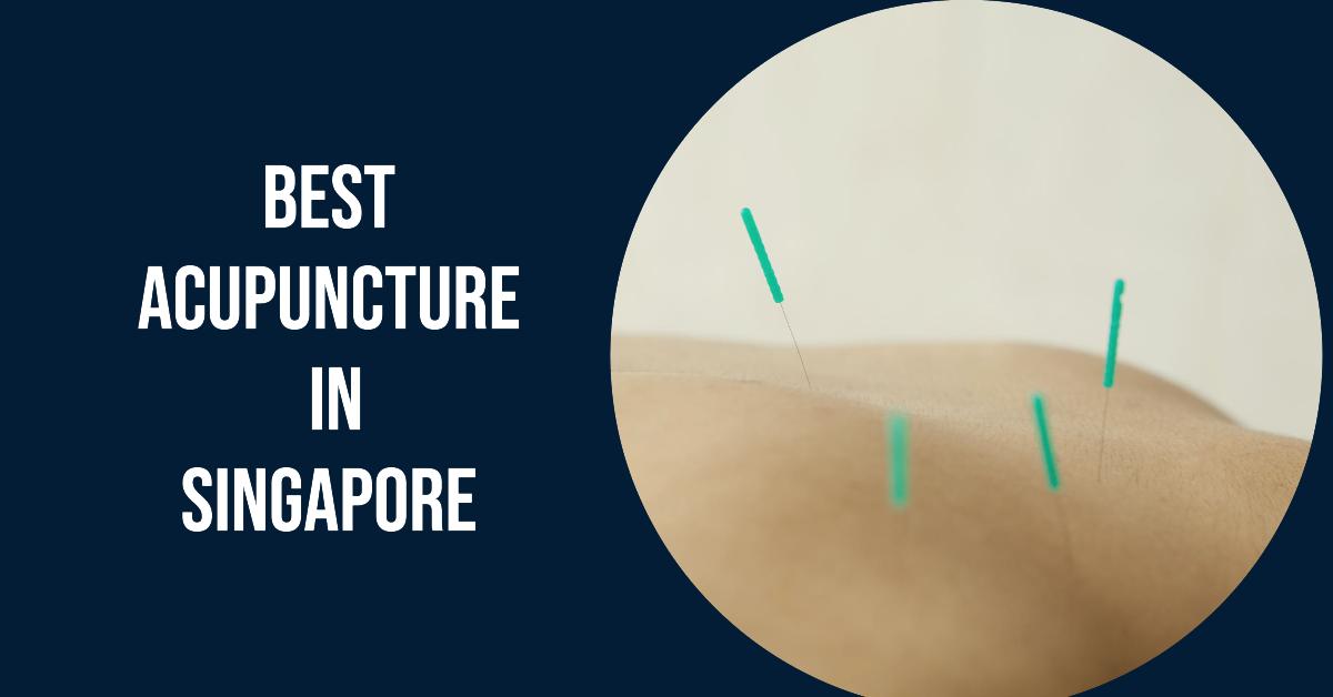 Best Acupuncture In Singapore (2026)