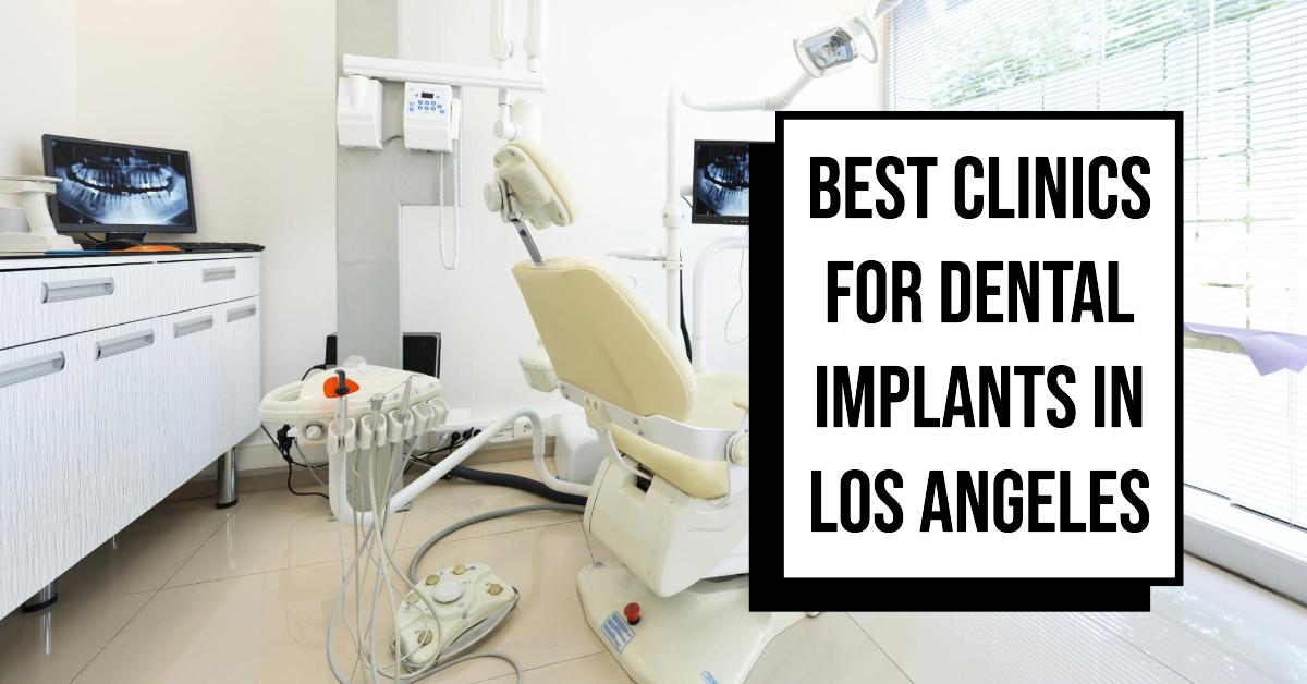 3 Best Clinics For Dental Implants In Los Angeles (2026)
