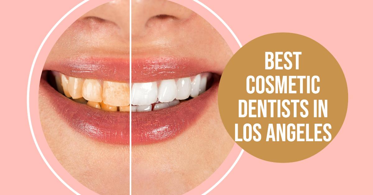 5 Best Cosmetic Dentists In Los Angeles (2026)