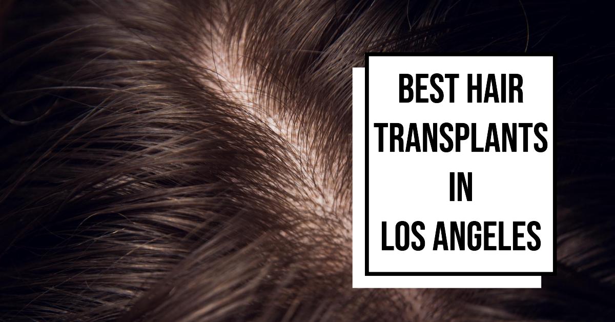 4 Best Hair Transplants In Los Angeles (2026)