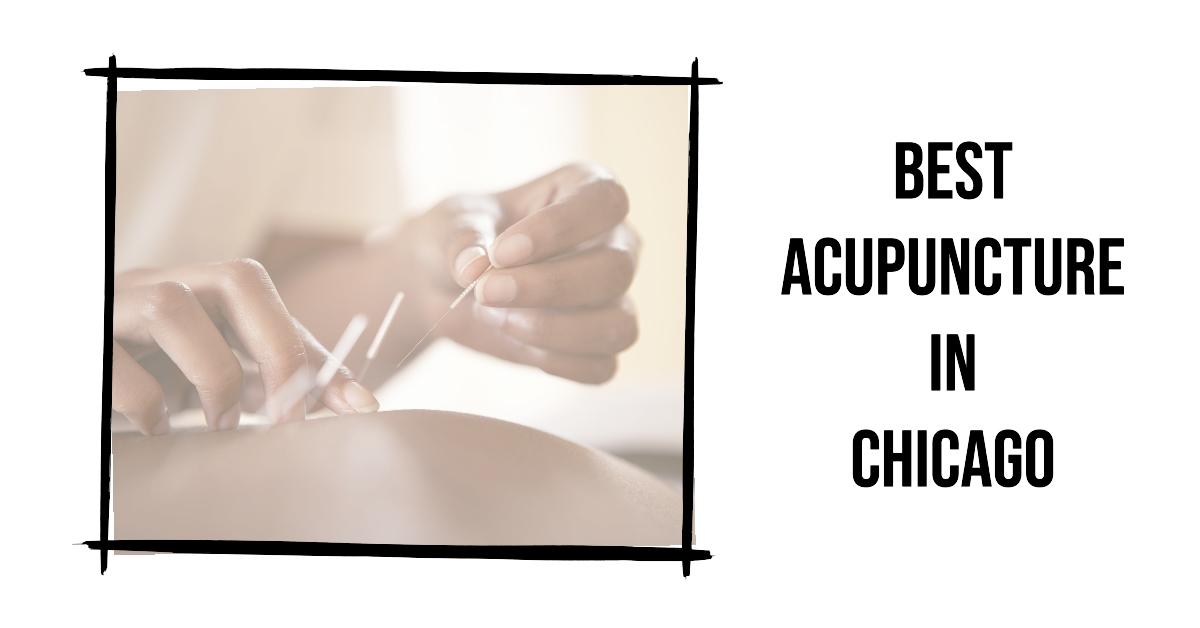 5 Best Acupuncture In Chicago (2026)