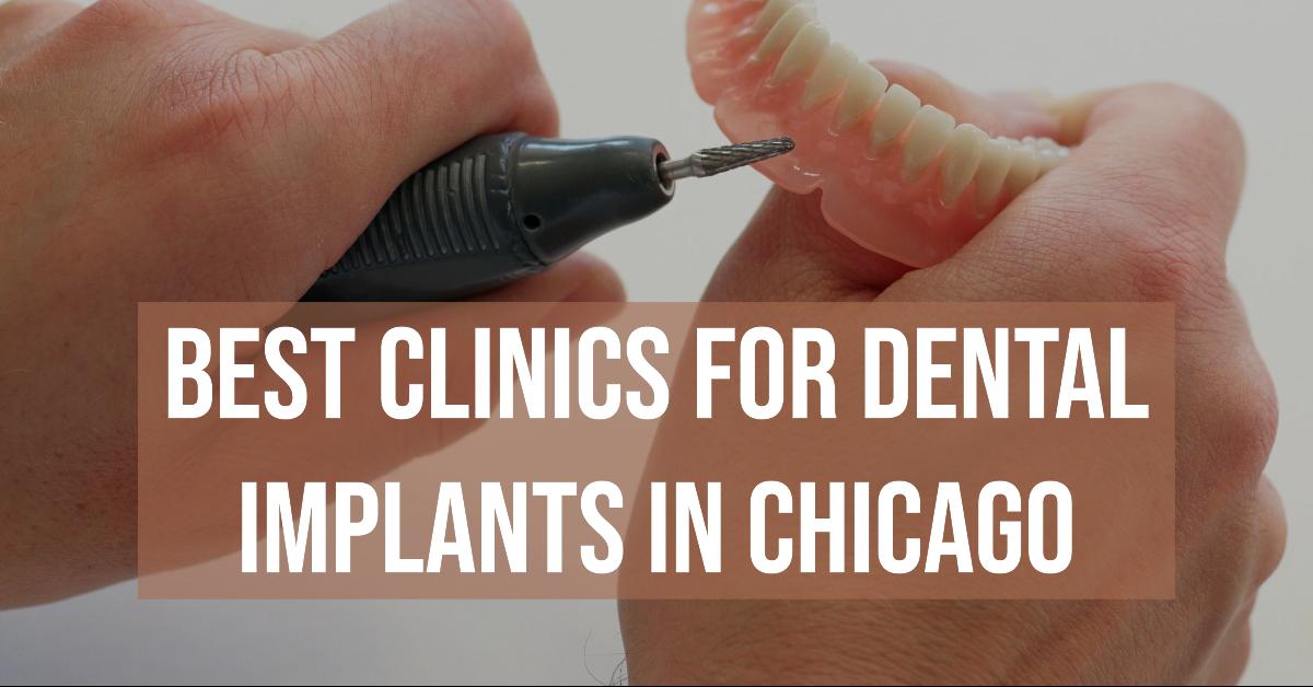 4 Best Clinics For Dental Implants In Chicago (2026)