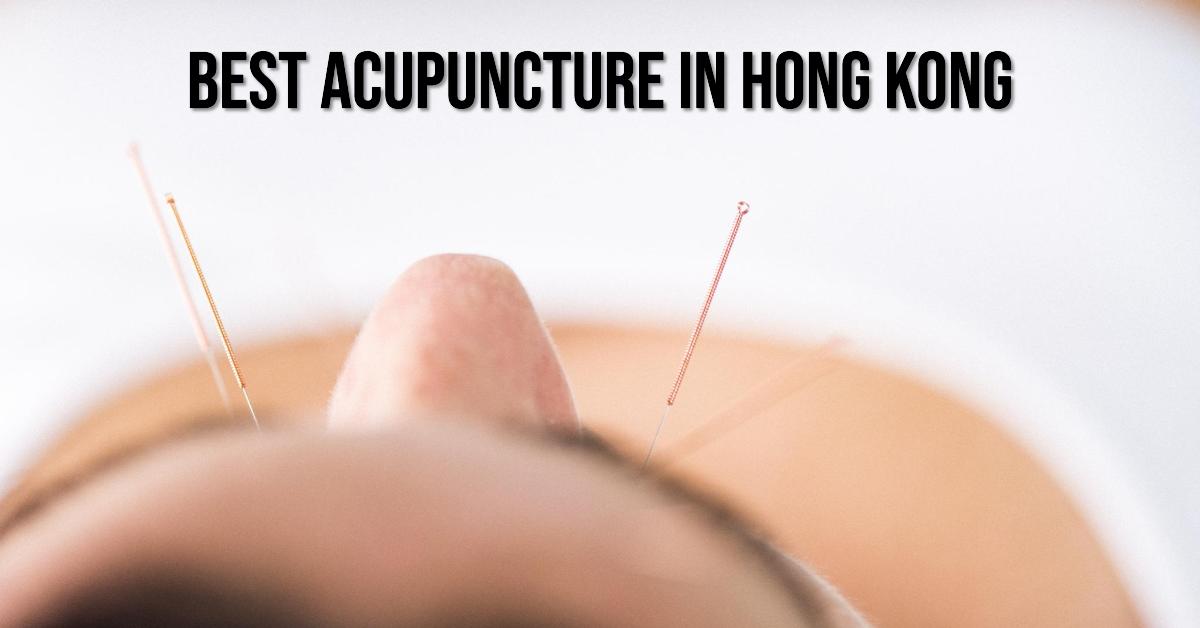 4 Best Acupuncture In Hong Kong (2026)