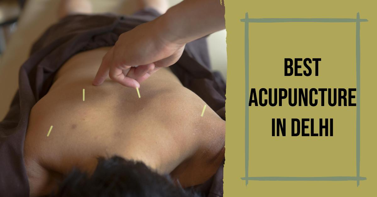 5 Best Acupuncture In Delhi (2026)