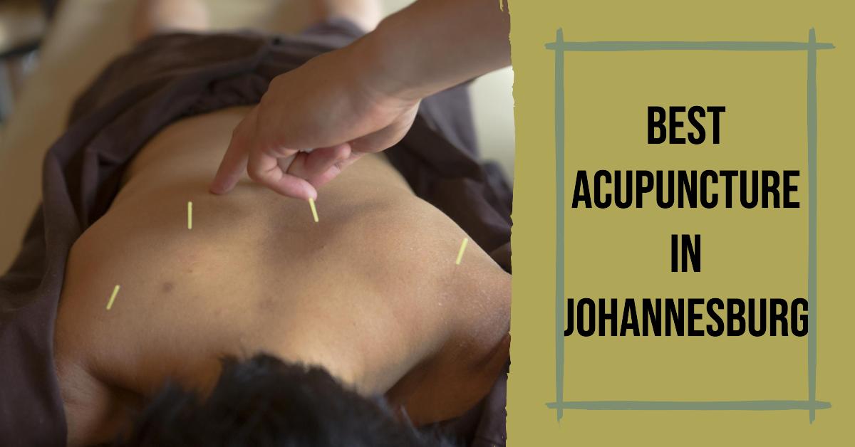 4 Best Acupuncture In Johannesburg (2026)