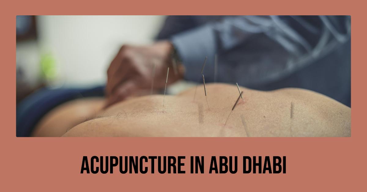 3 Best Acupuncture In Abu Dhabi (2026)