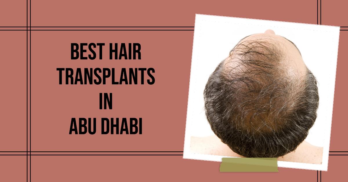 4 Best Hair Transplants In Abu Dhabi (2026)