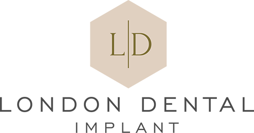 London Dental Implant logo